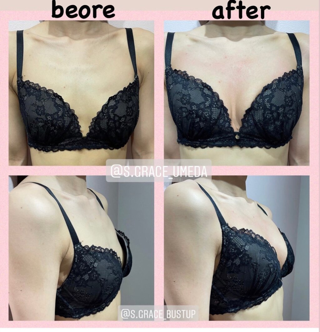 驚異のbefore after！！！