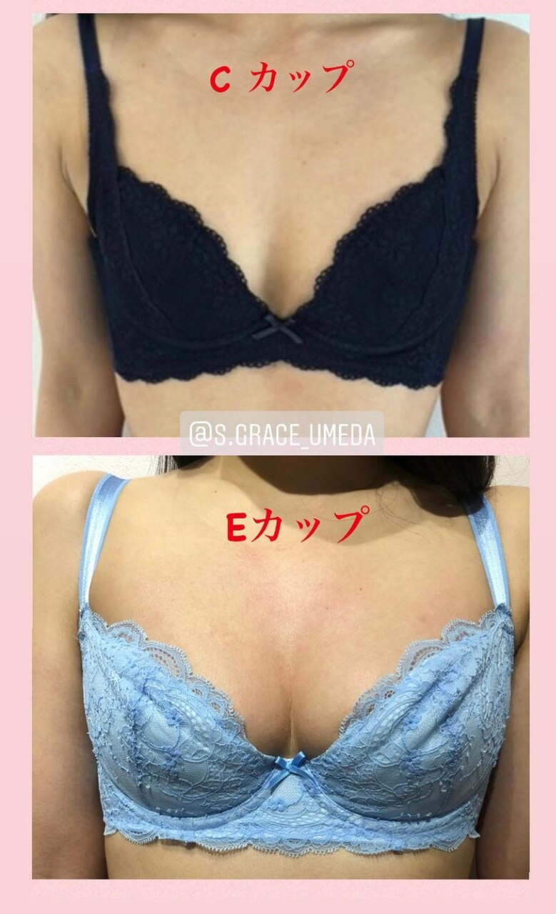 バストの左右差は整えれます！バストアップします(^^)