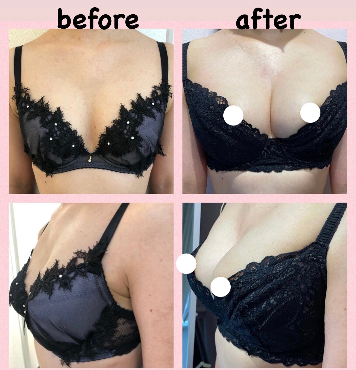 驚異のbefore,after