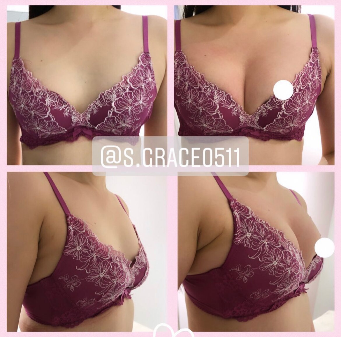 before,after