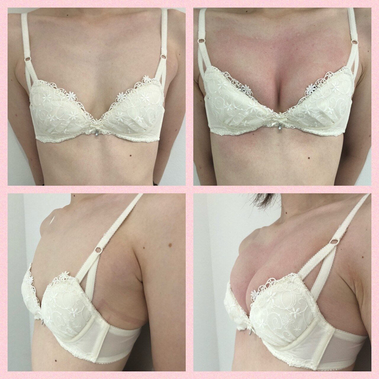 驚異のbefore,after