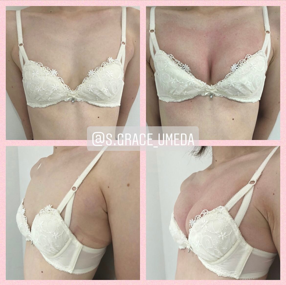 育乳バストアップ!施術before,after