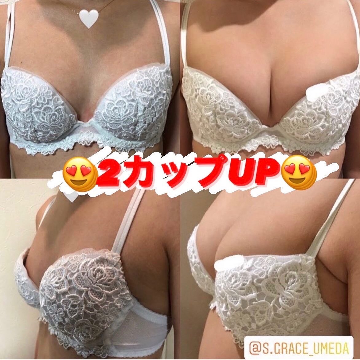 シンデレラバストアップbefore,after
