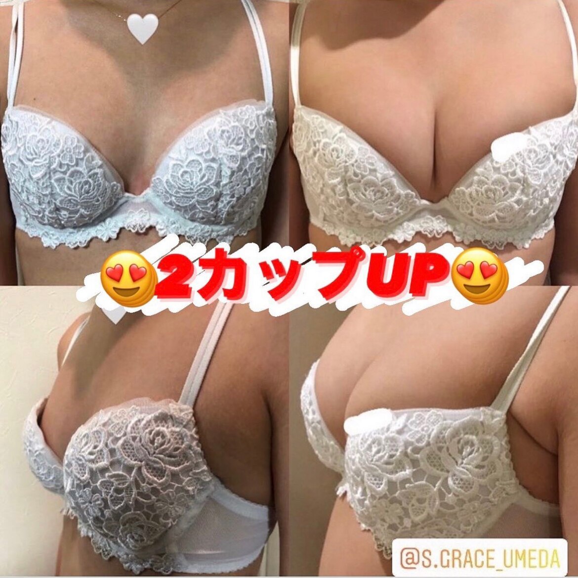 大人気ハイフボディで痩せながらバストアップ?!