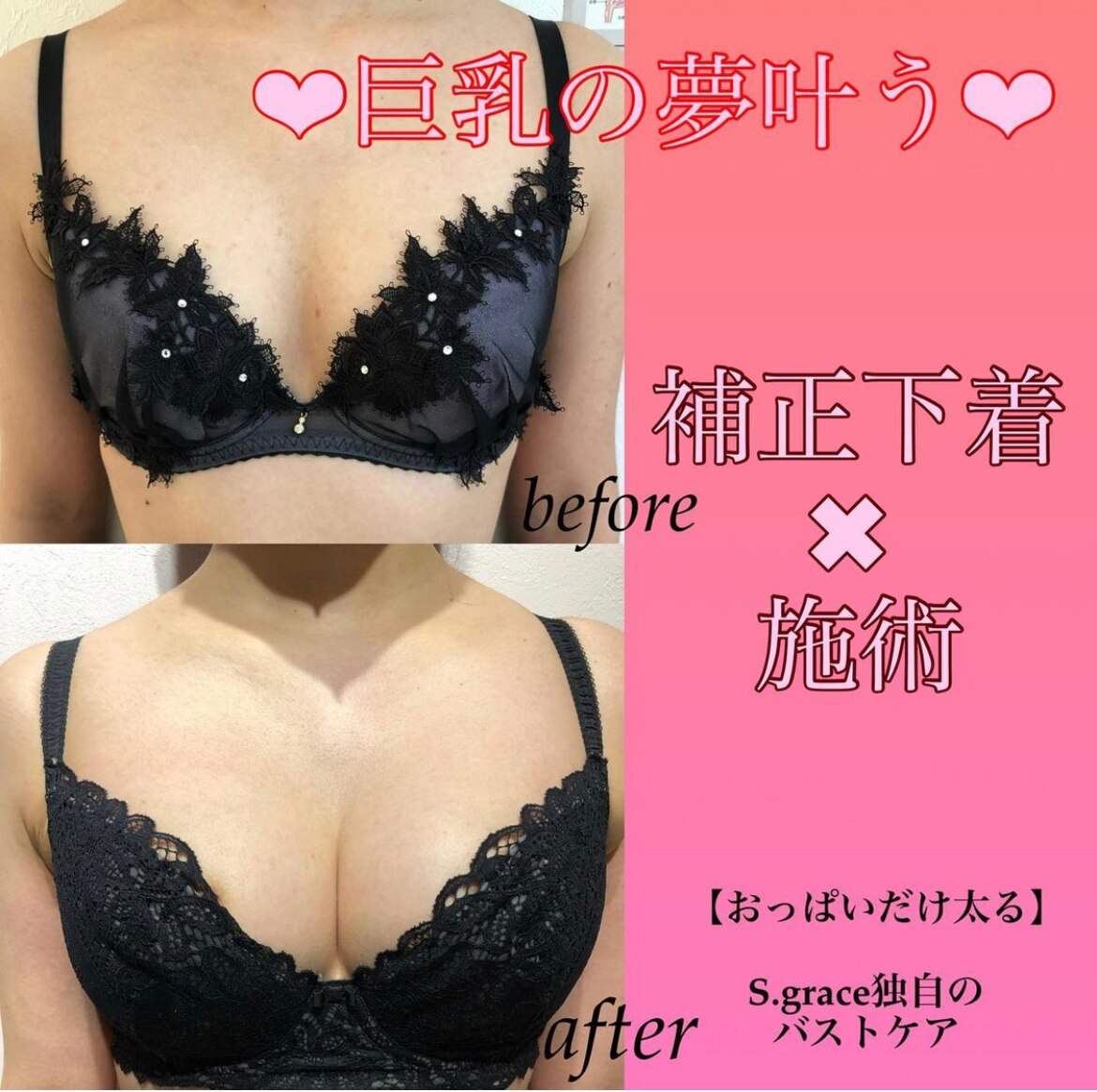 大人気アイリーン式育乳マッサージ！