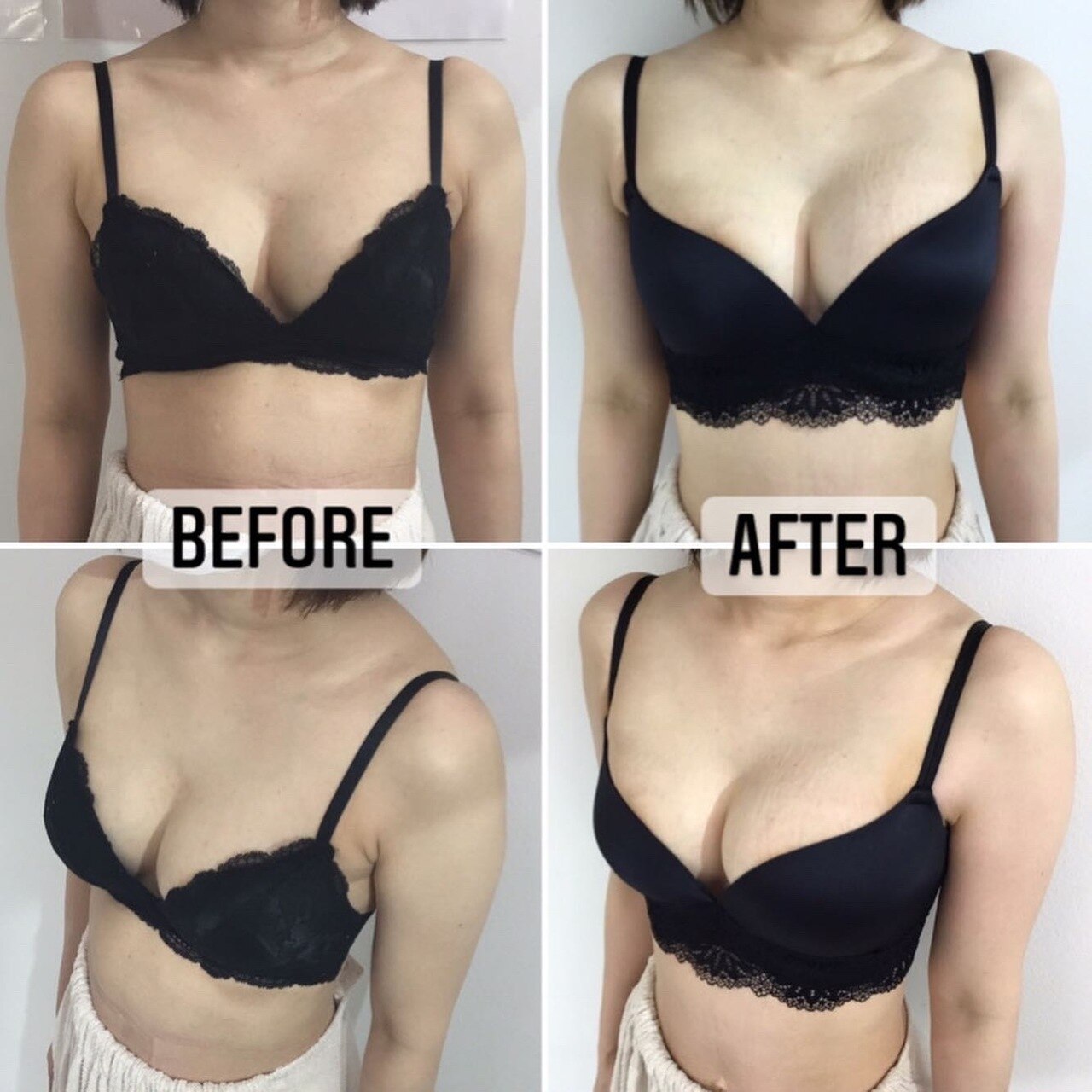 大人気育乳マッサージ！！Before After☆
