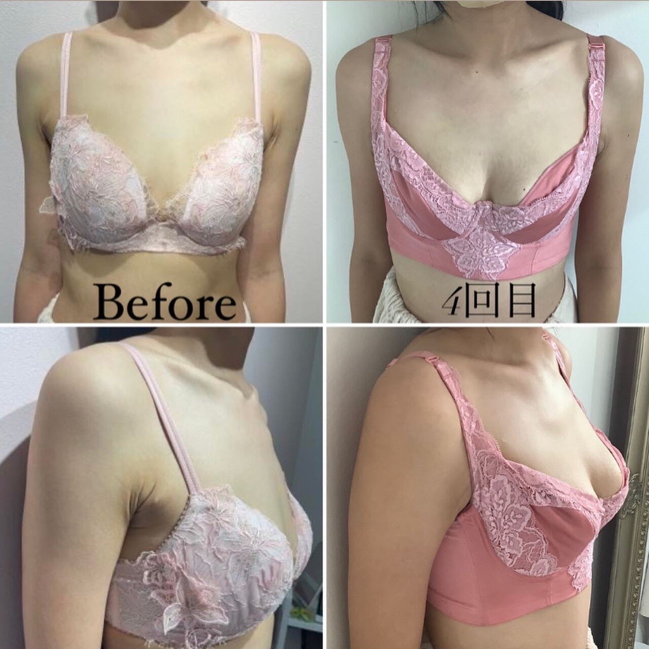 萎んだ授乳後のバストもボリュームUP↑