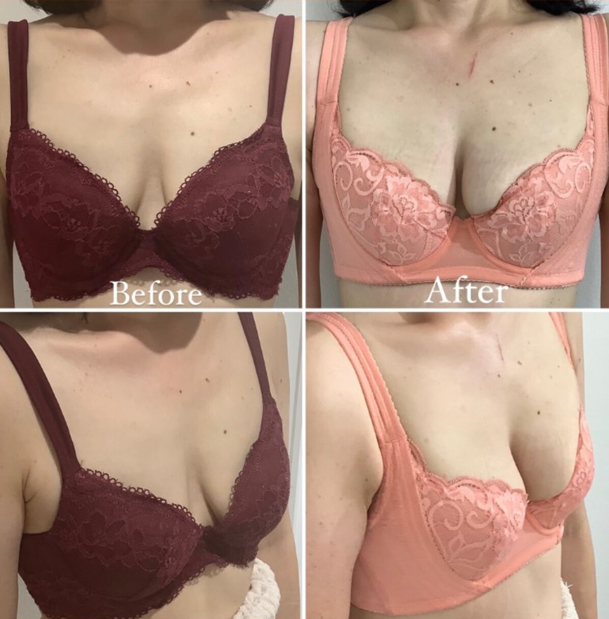 50代前半のお客様Before After