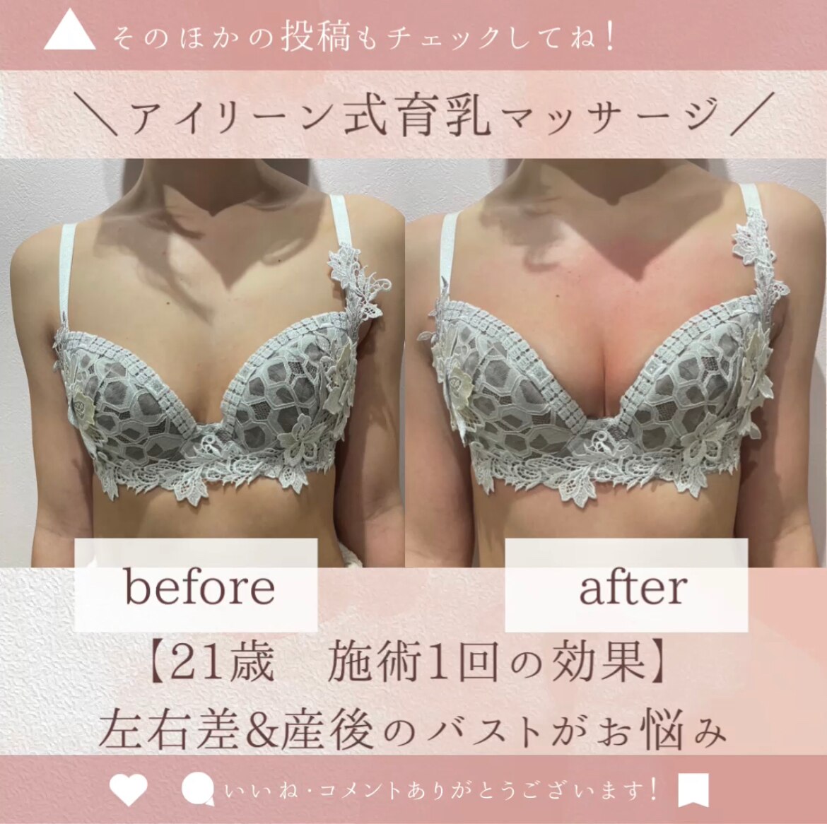 アイリーン式育乳マッサージ！驚愕のbefore,after