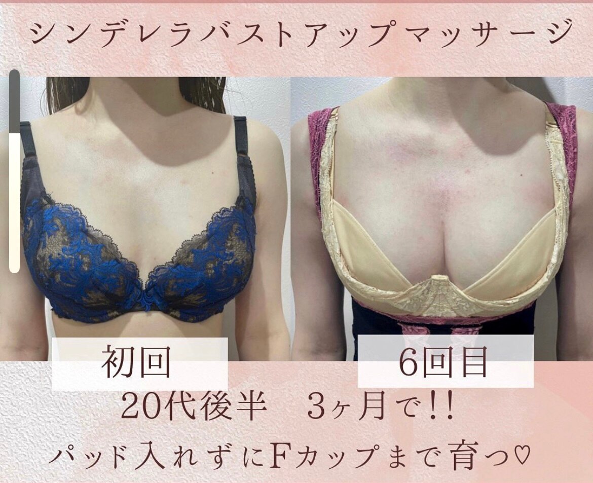 ☆豊胸せずFカップまで育つ☆
