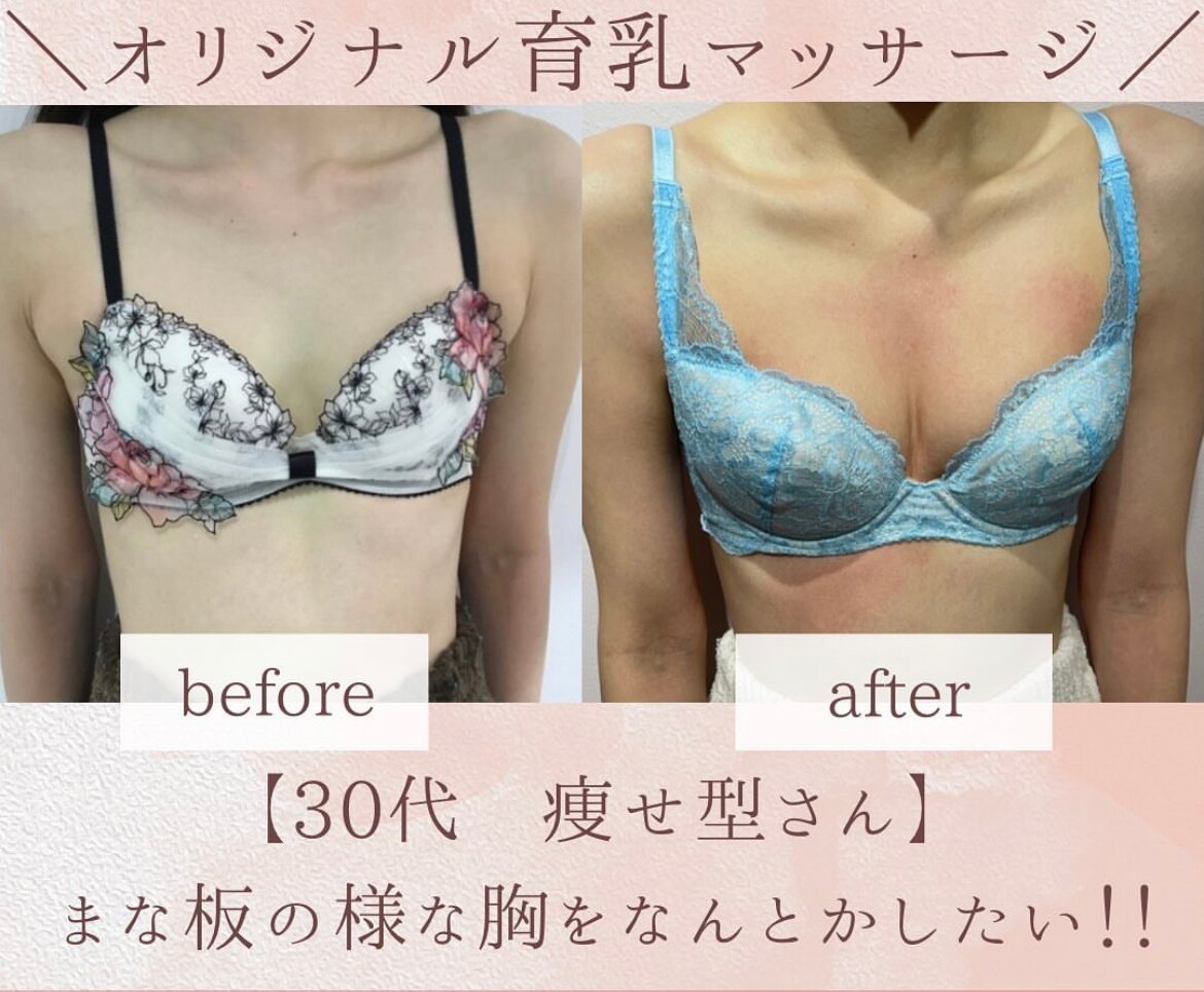 Bカップから念願のDカップ！！