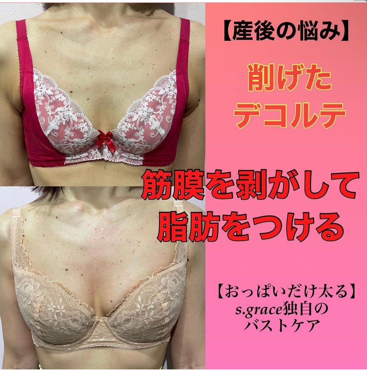 40代出産歴ありのお客様☆