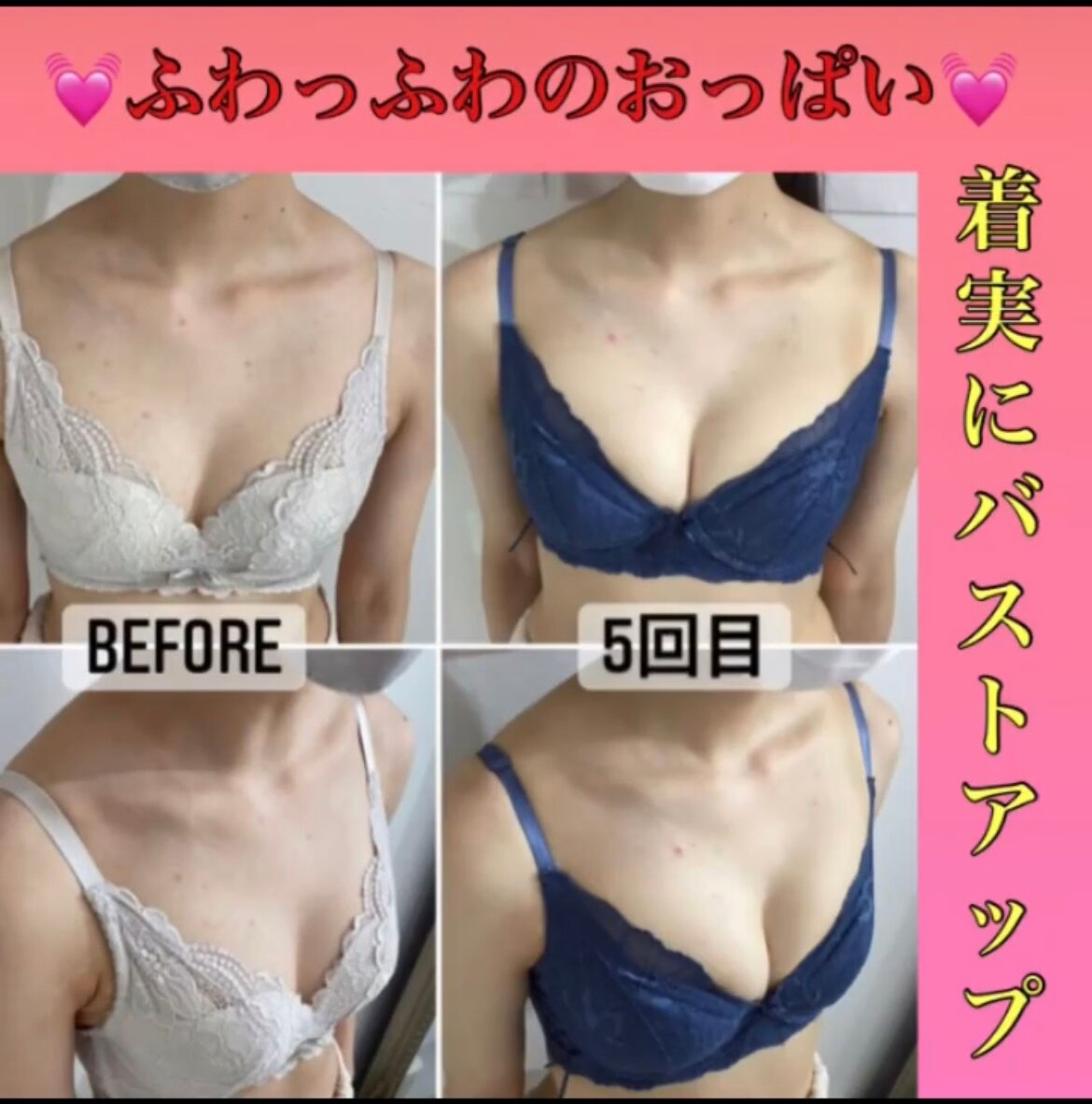 施術5回目のビフォー、アフター☆