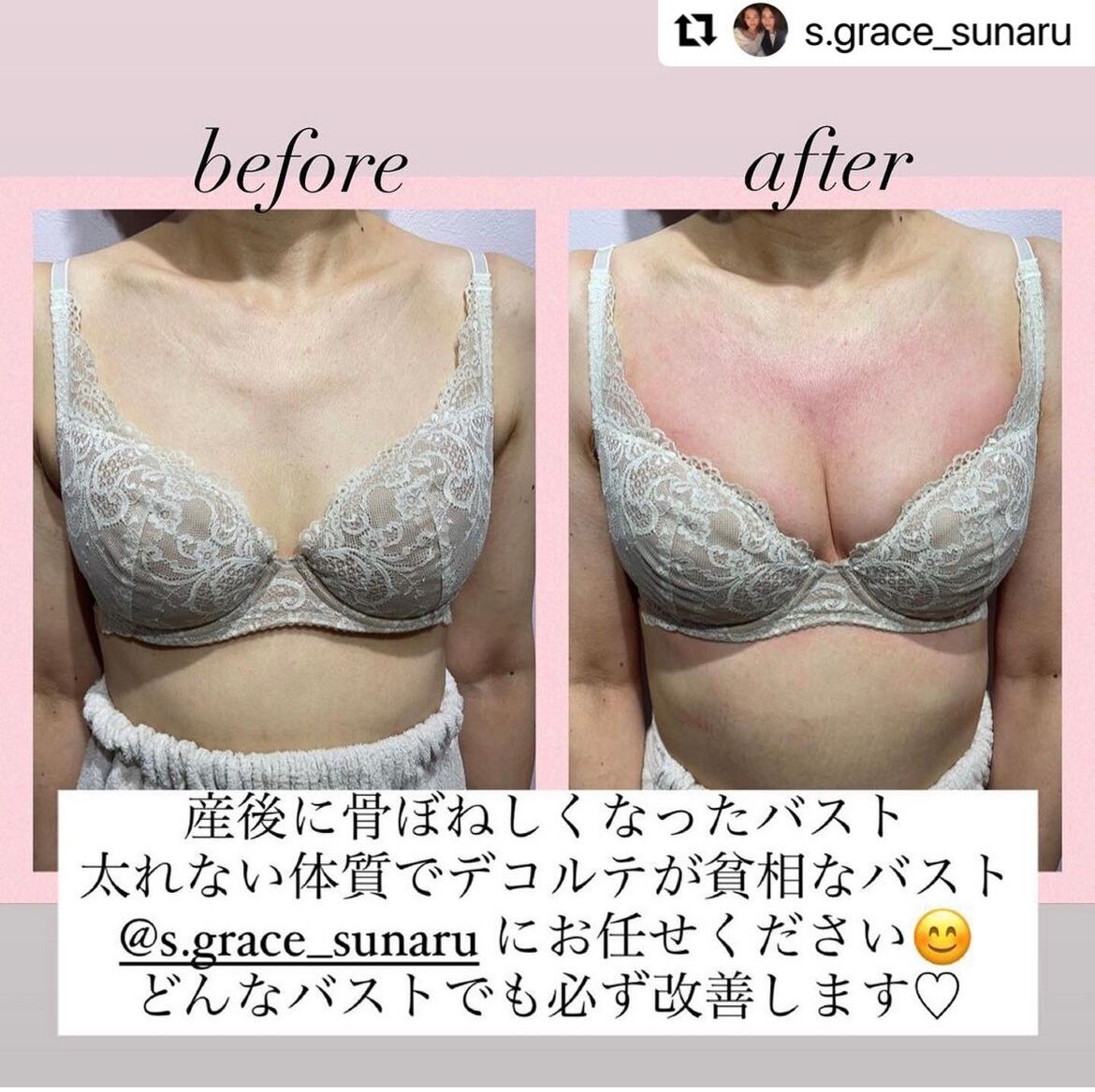 施術一回のビフォーアフター♪