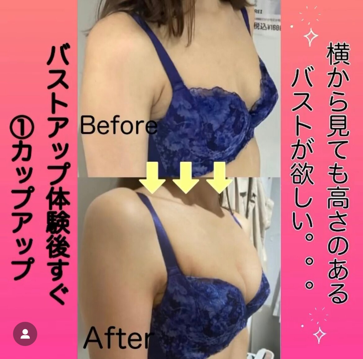 施術1回のビフォーアフター♪