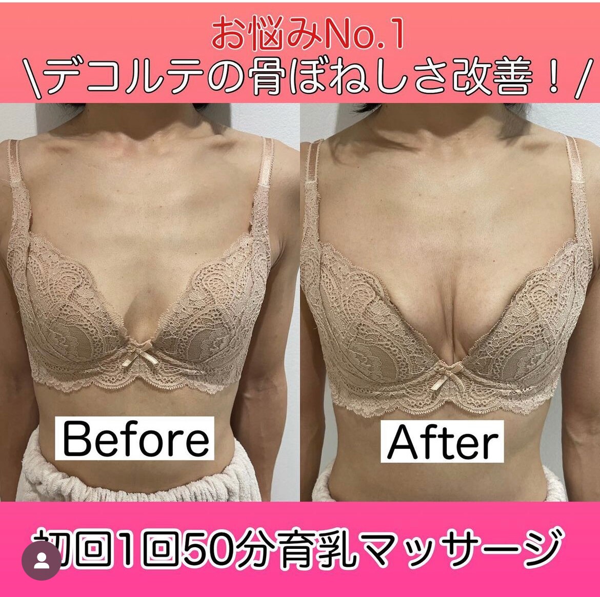デコルテの骨ぼねしさ改善!