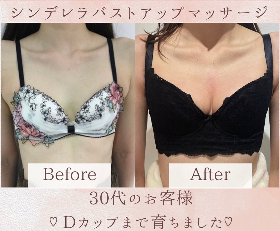 Bカップから念願のDカップ(^^)！！
