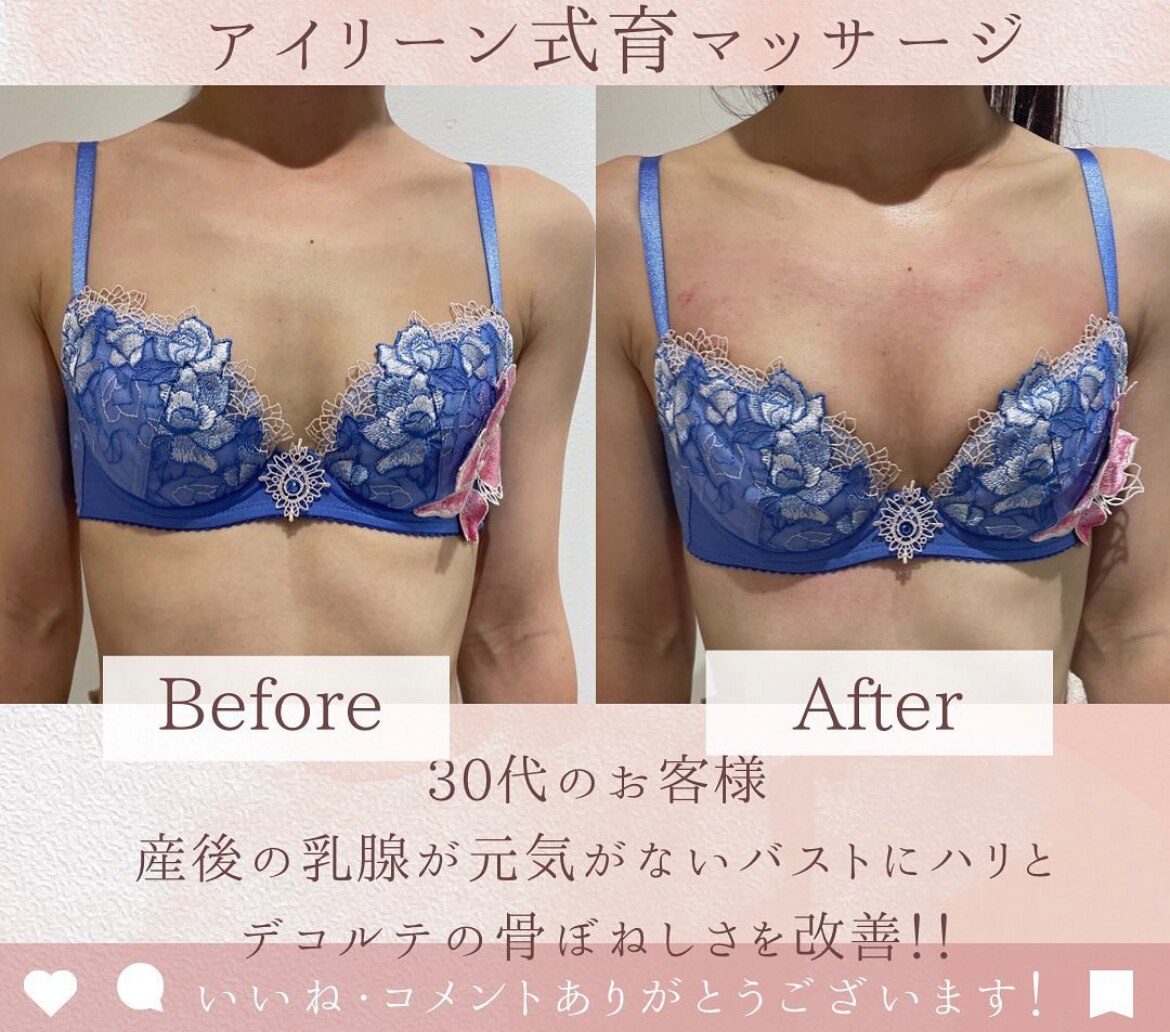 1回の施術Before,After!!