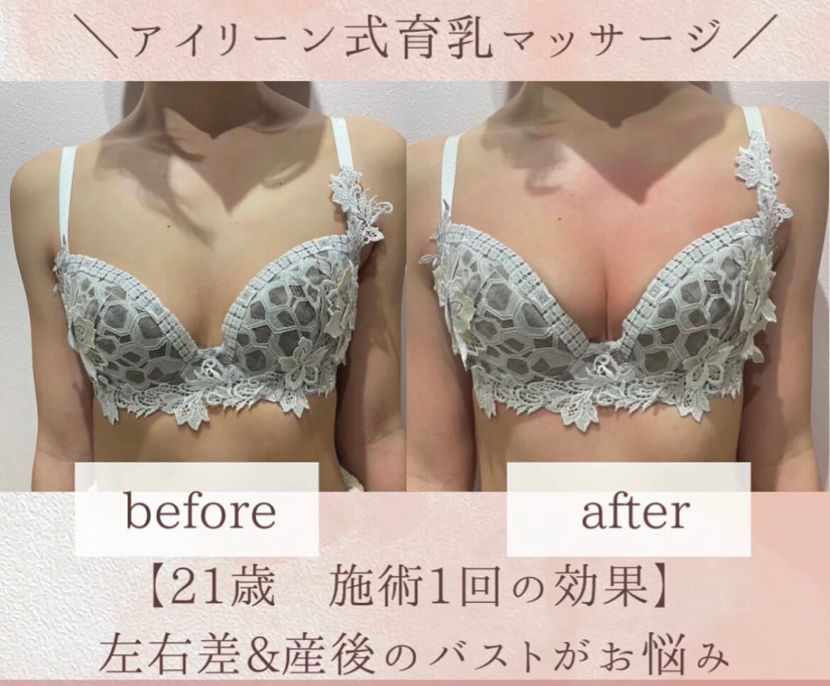 21歳のお客様☆施術一回!!