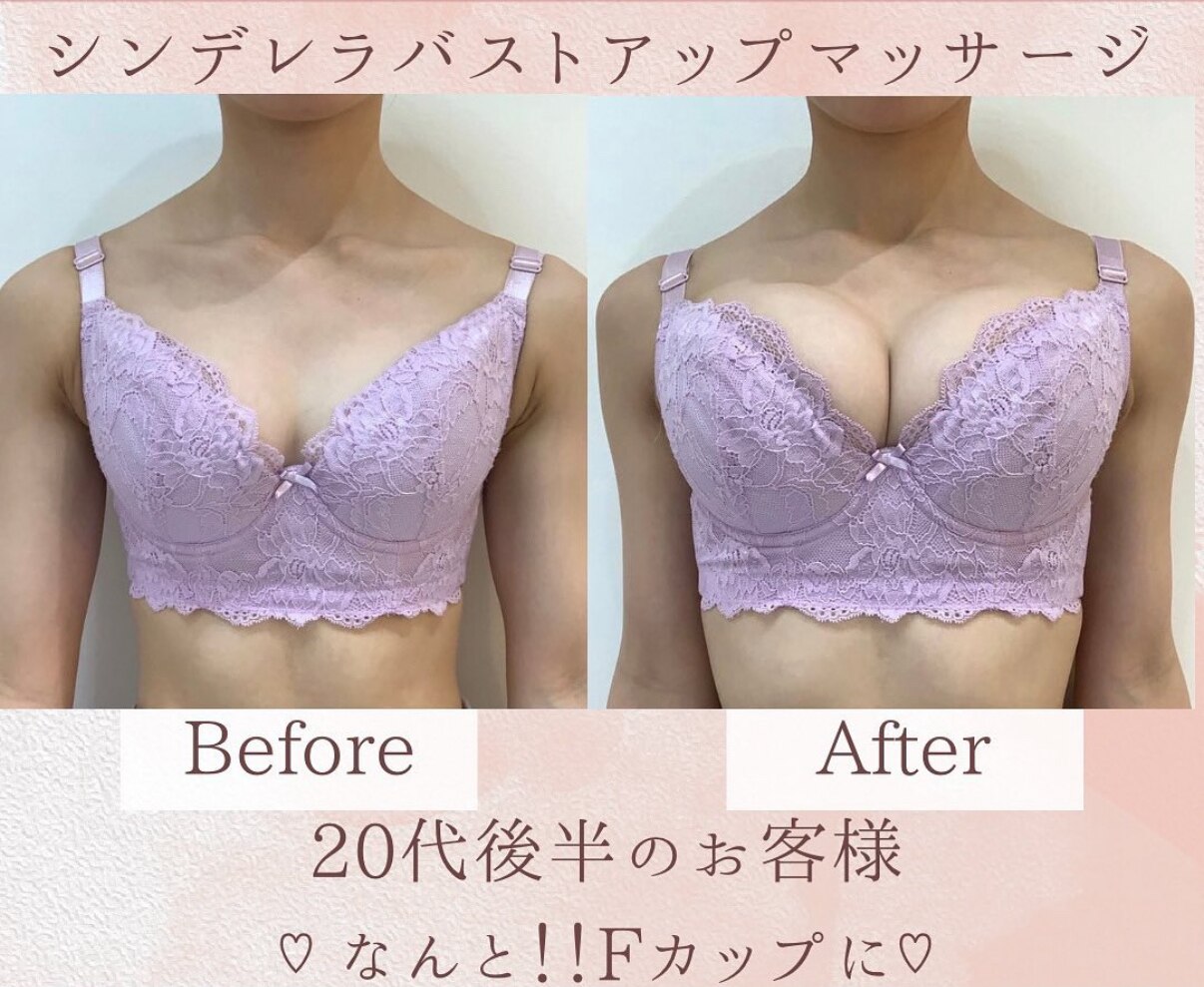 驚愕のbefore,after