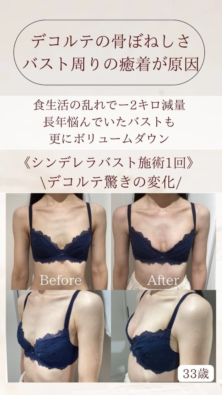 デコルテの骨ぼねしさ改善！