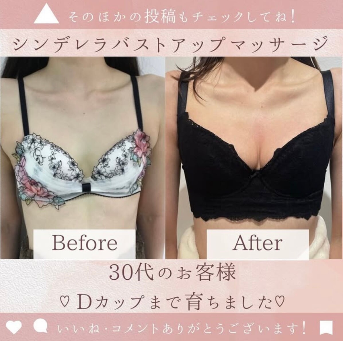 Bから念願のDカップに!