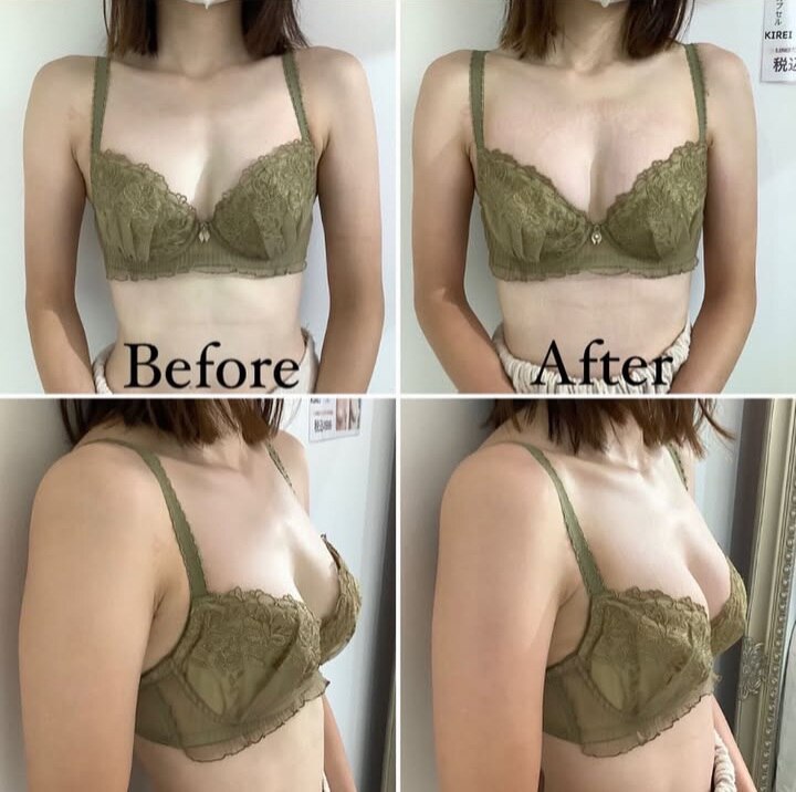 衝撃before・after