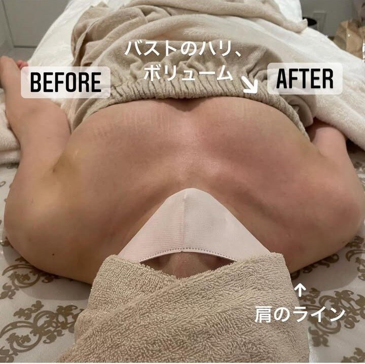 【梅田 バストケア】こんなにバストにハリが!