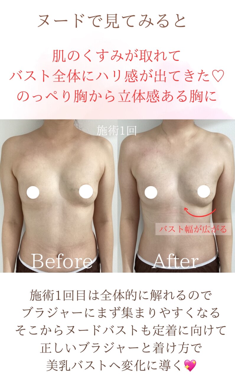 【梅田　バストケア】ヌード幅が広がる！☆