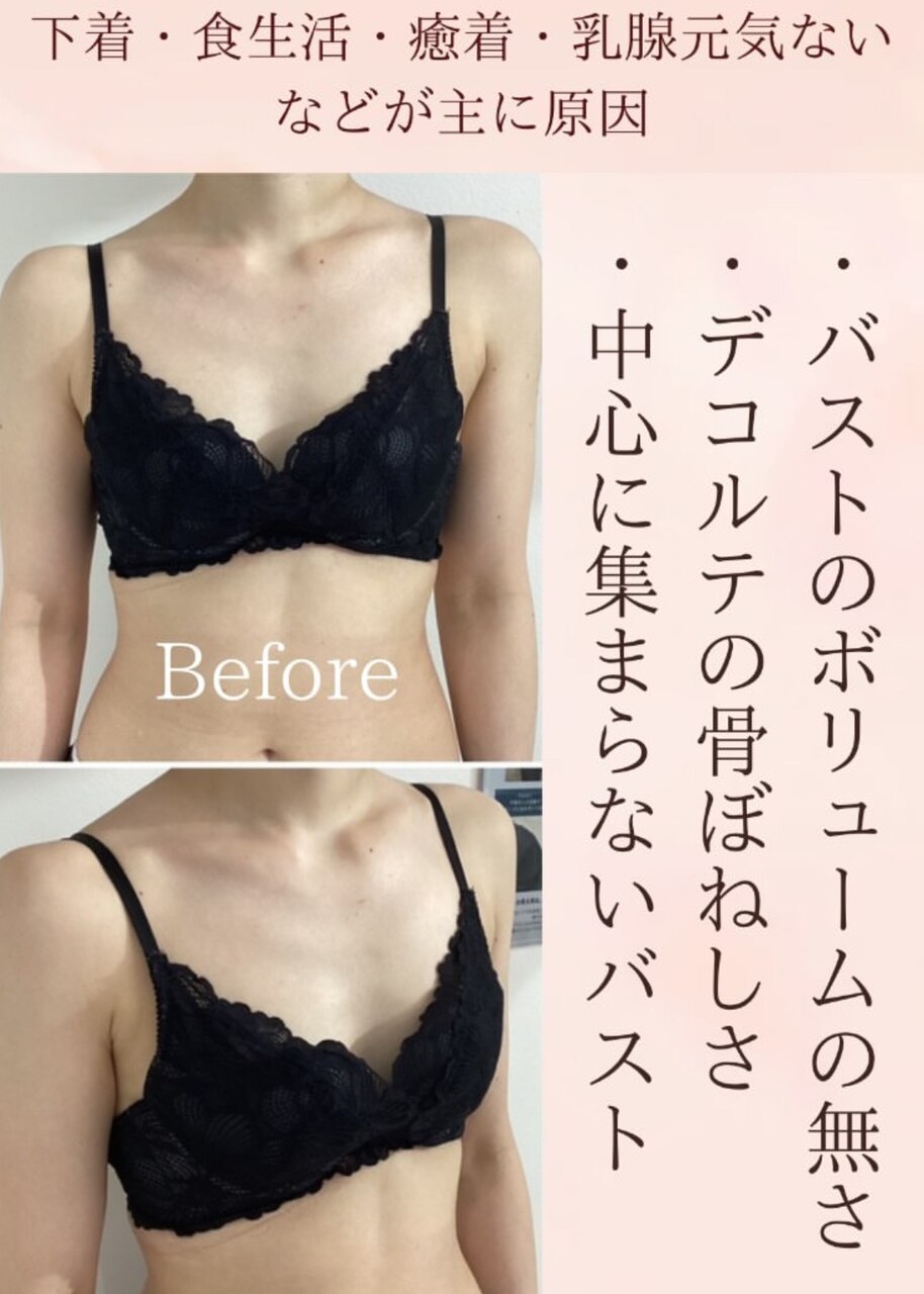 【梅田バストケア】施術後、自分史上1番のバストへ☆