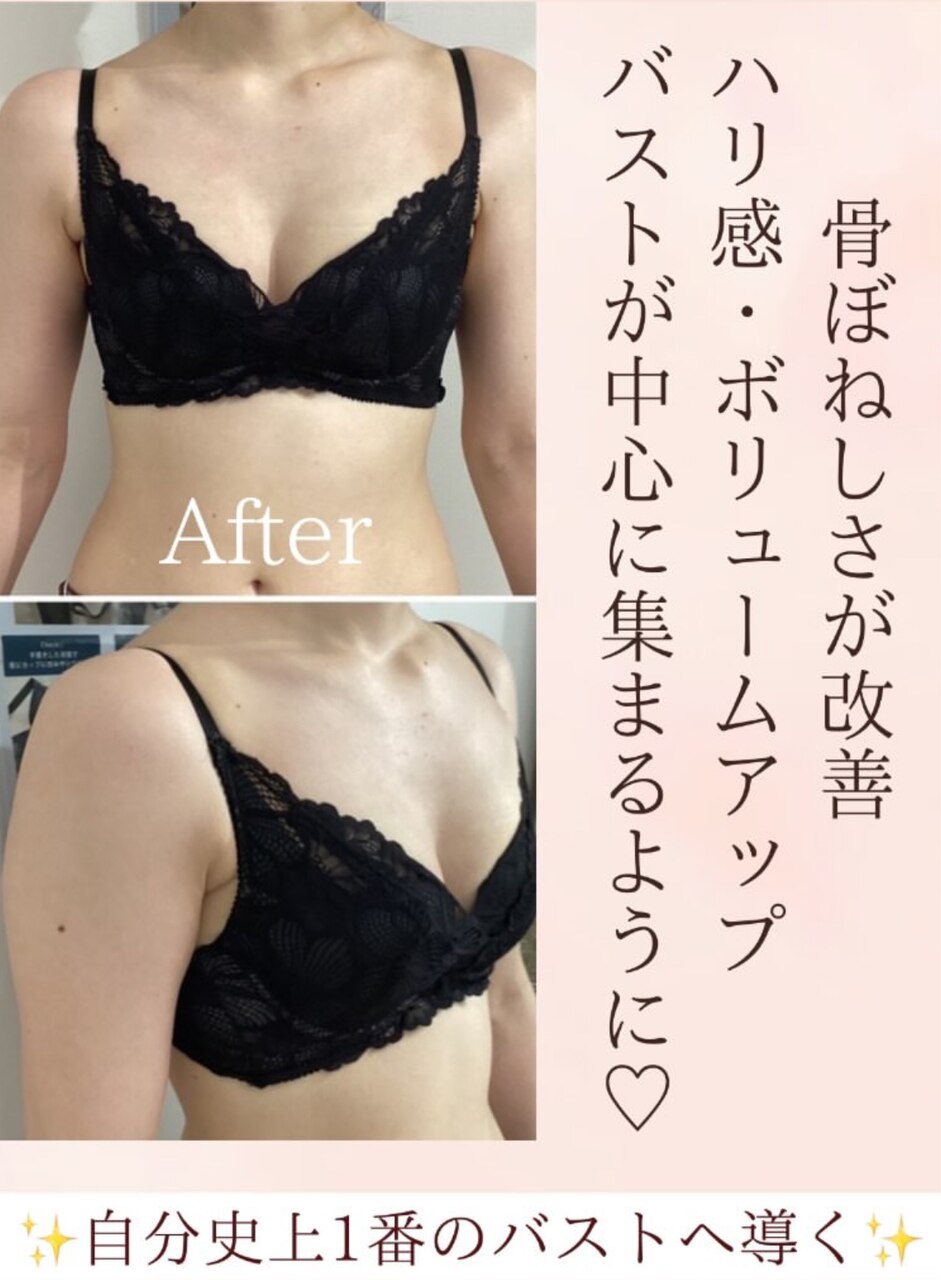 【梅田バストケア】施術後、自分史上1番のバストへ☆