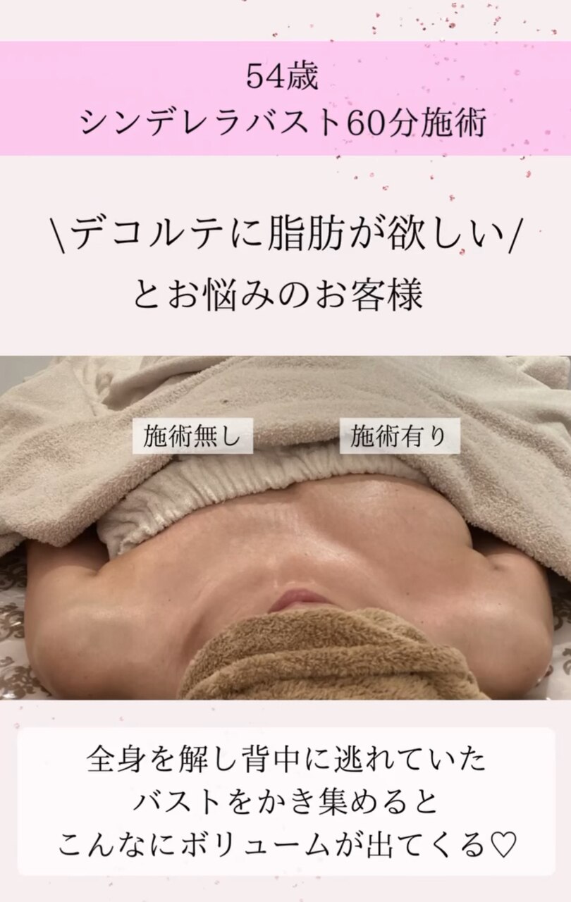 施術一回でのバストアップ効果凄すぎ☆