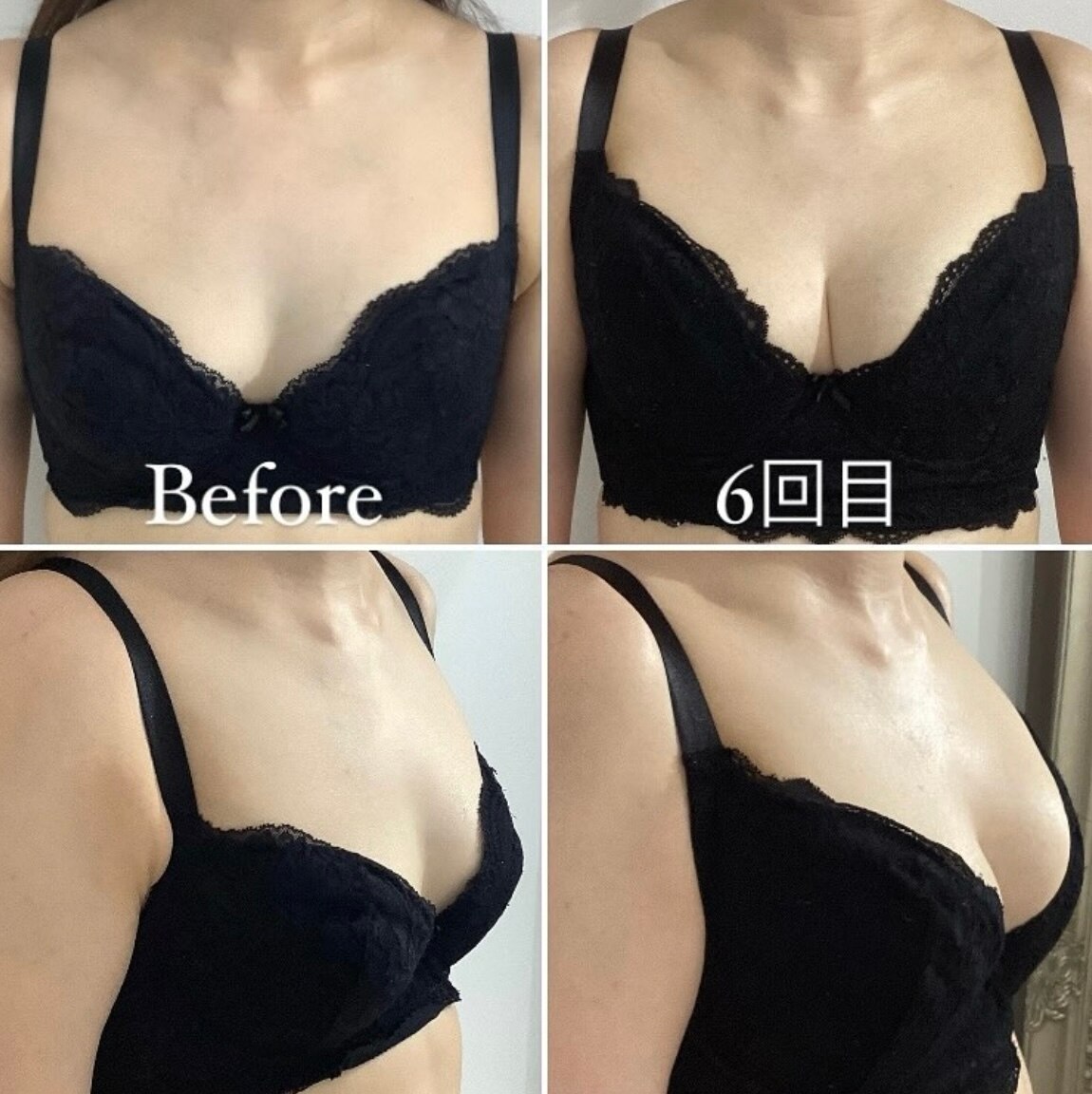 産後の元気のないバストもなかったことに!バスト復活