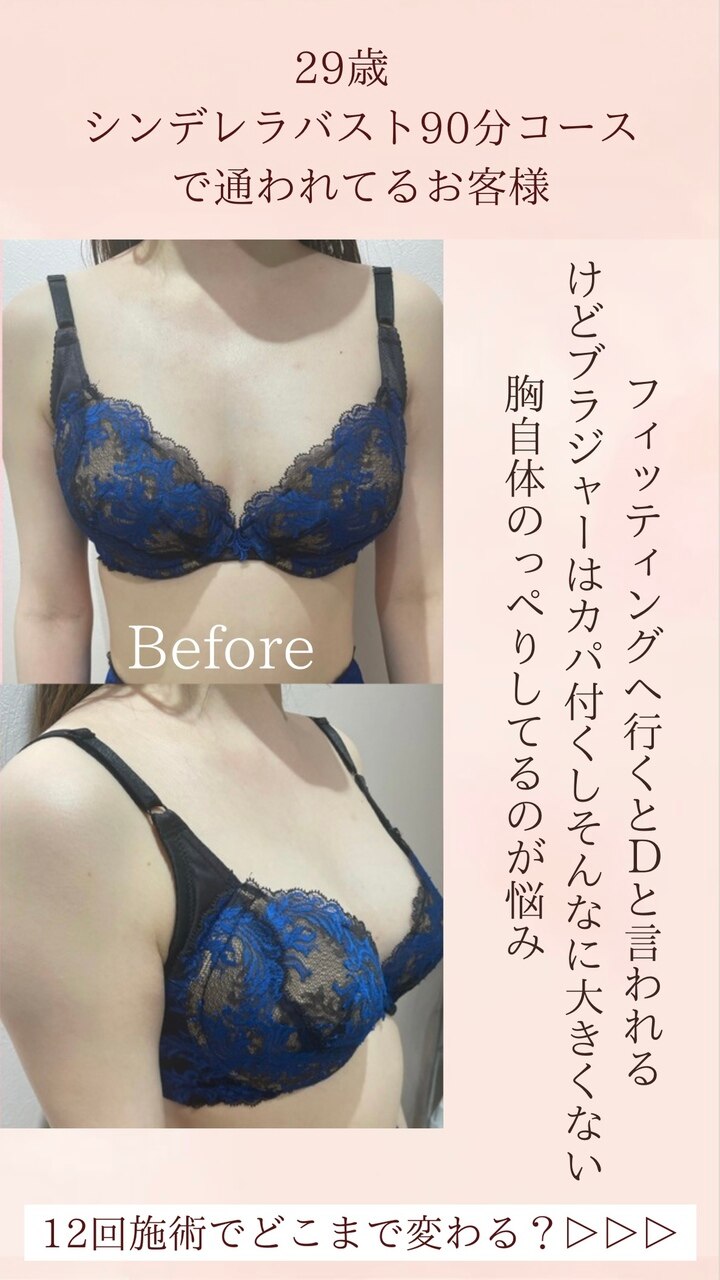 D→Gカップに♪豊胸なしでここまで変われる!