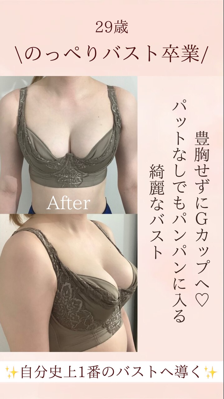 D→Gカップに♪豊胸なしでここまで変われる！