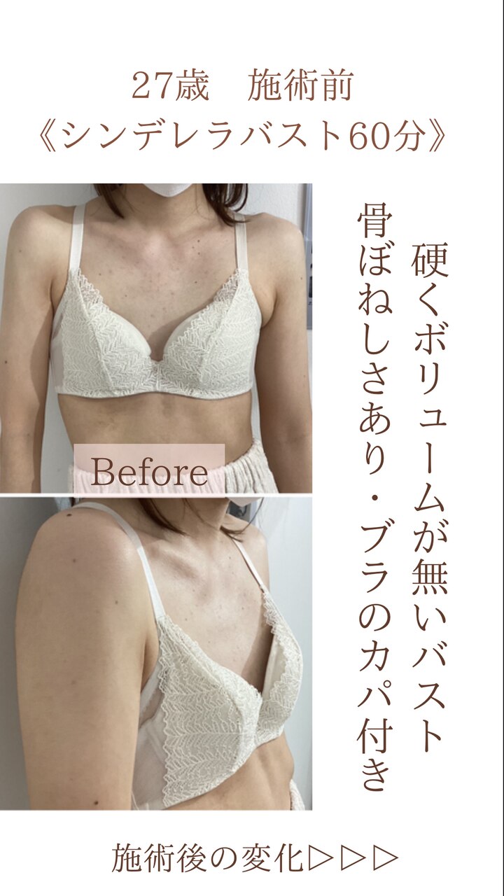 バストのお悩みは『今』改善しないと!