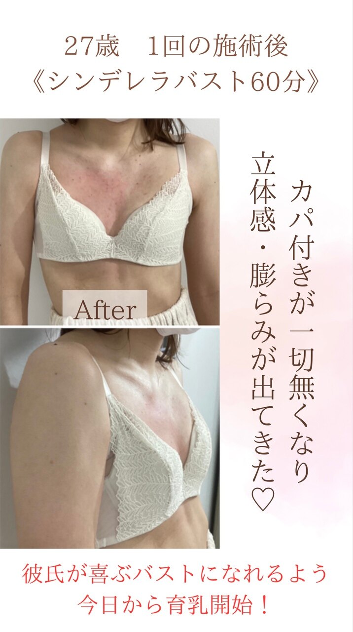 バストのお悩みは『今』改善しないと！