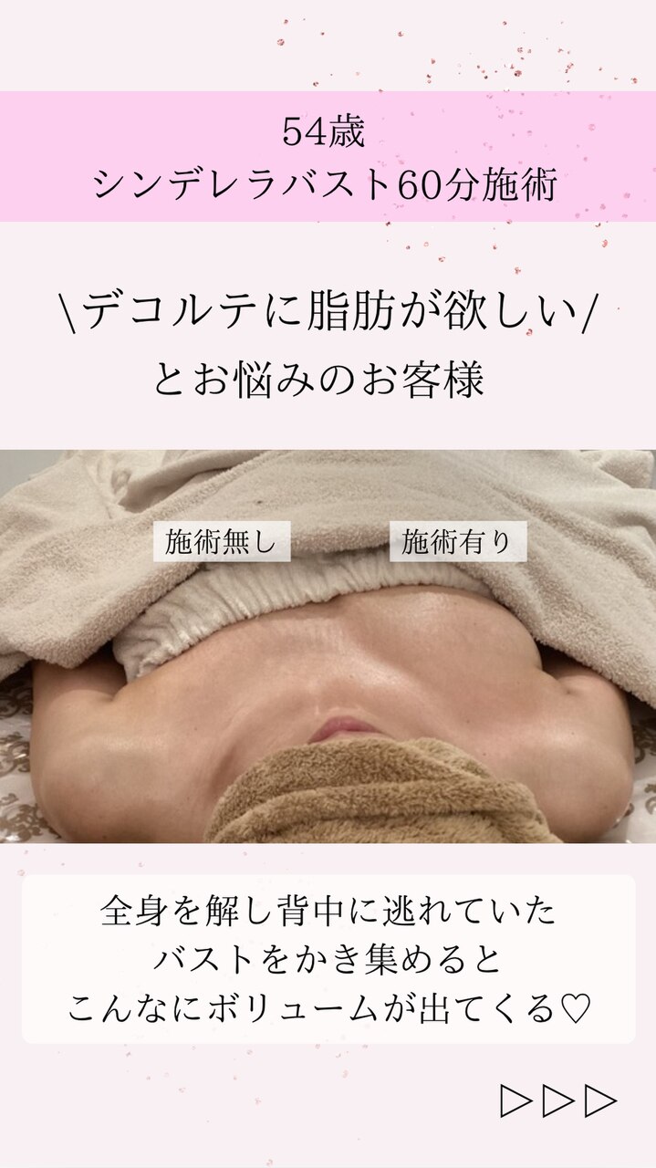背中のお肉をバストへ!!デコルテふんわり♪