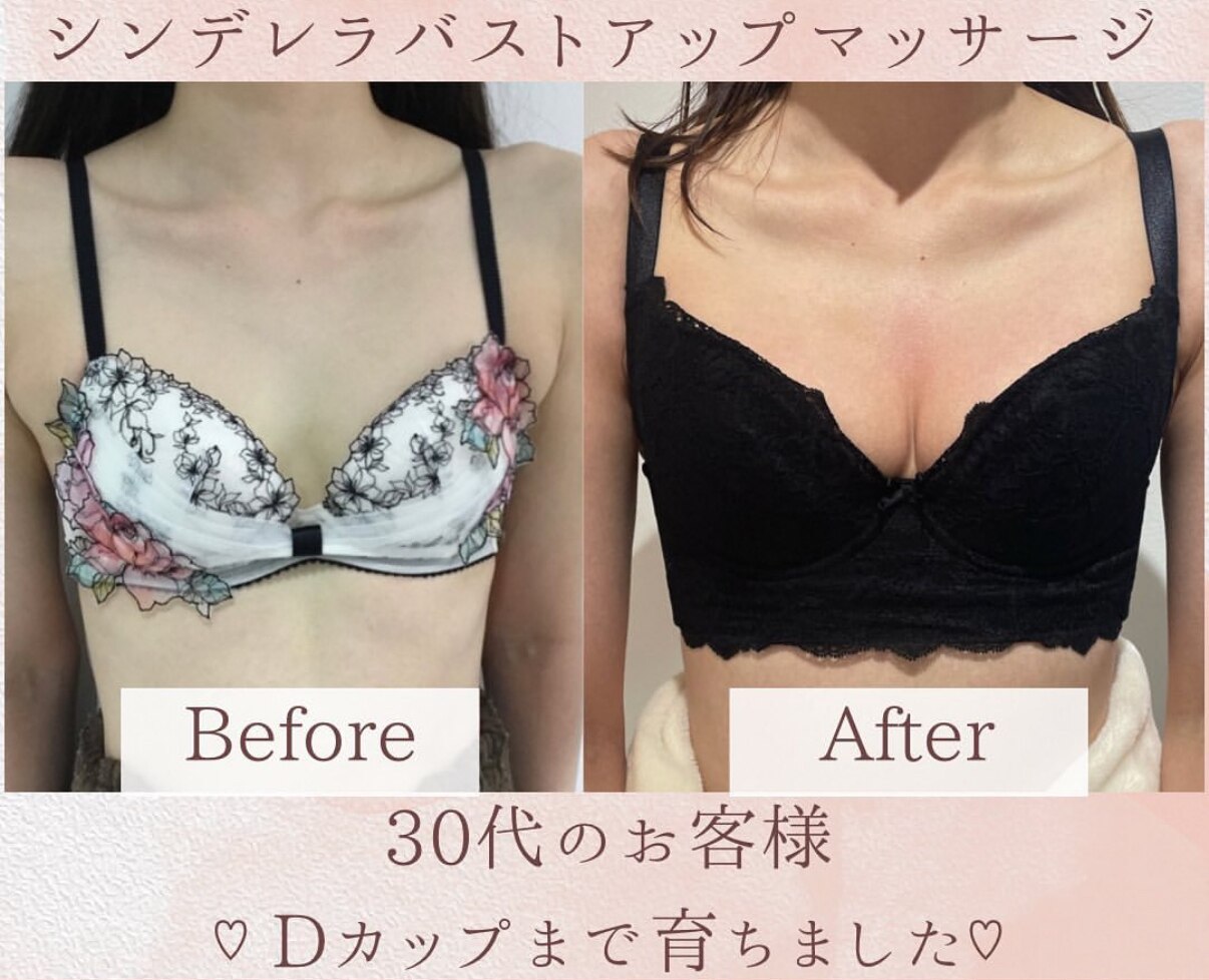 豊胸せずにバストアップ!!??