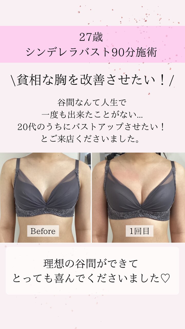 貧乳からGカップまでバストアップした話！