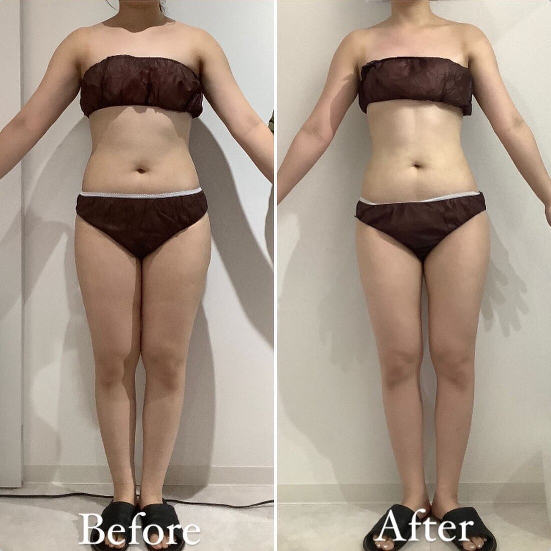 ダイエットで胸がなくなった