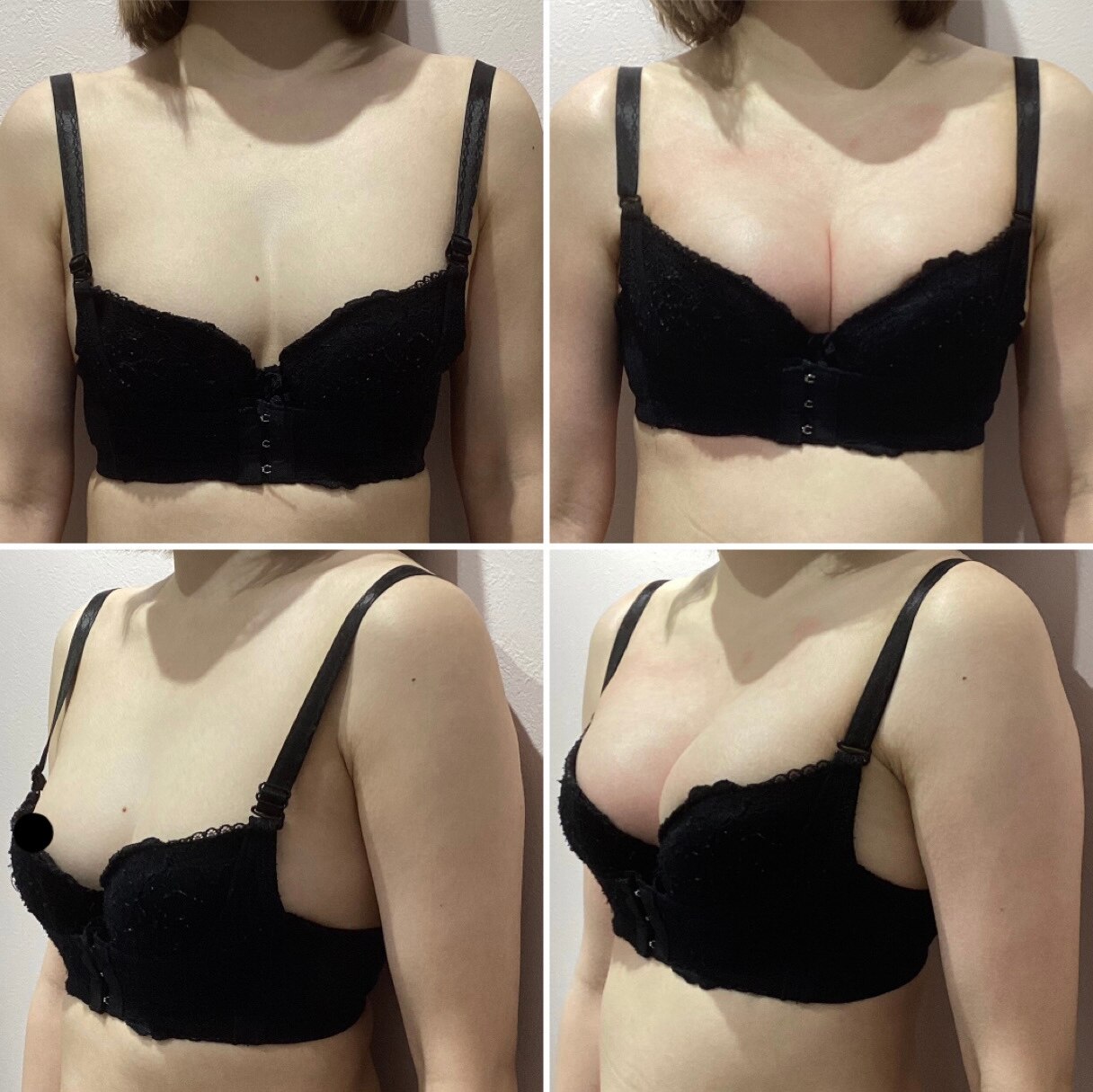痩身エステに通ってから貧乳に??
