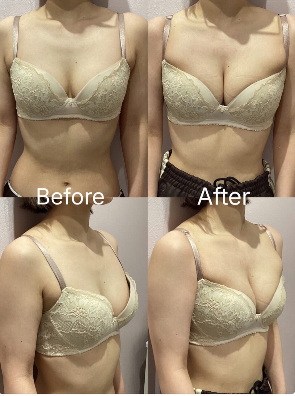 必ずバストアップしたい方！不安な方にはこれ！