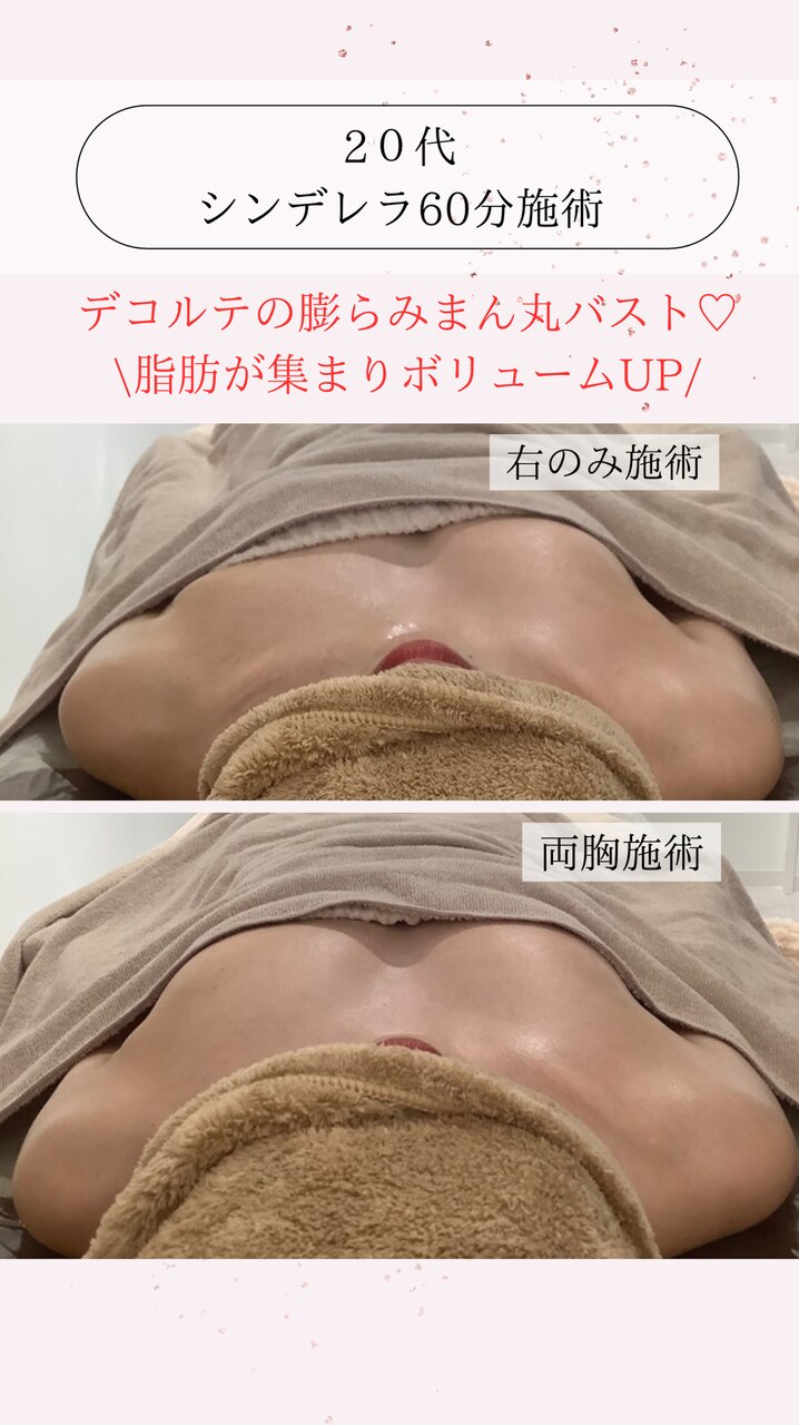 戻らない土台作りから始める本格バストケア