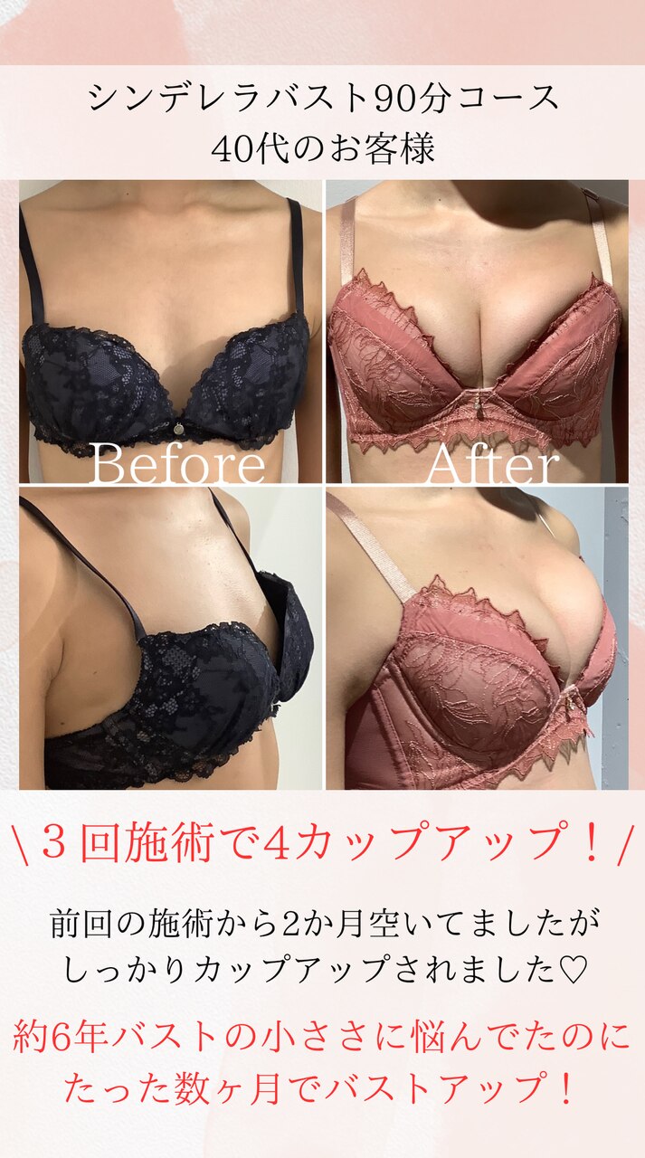 ブラジャーがカパつくあなたへ