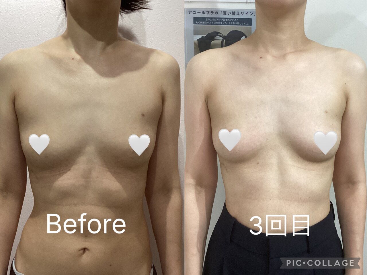あなたのなりたいバストの理想を現実に変えませんか？