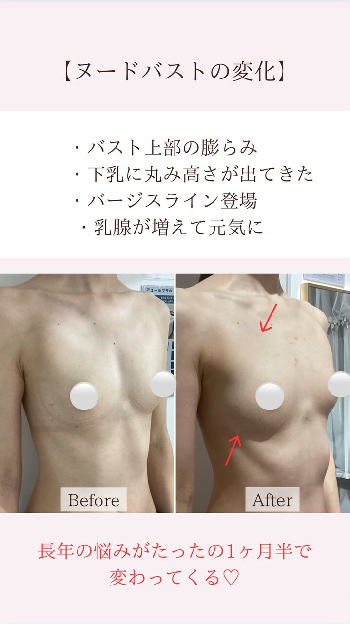バージスラインを作るためには？