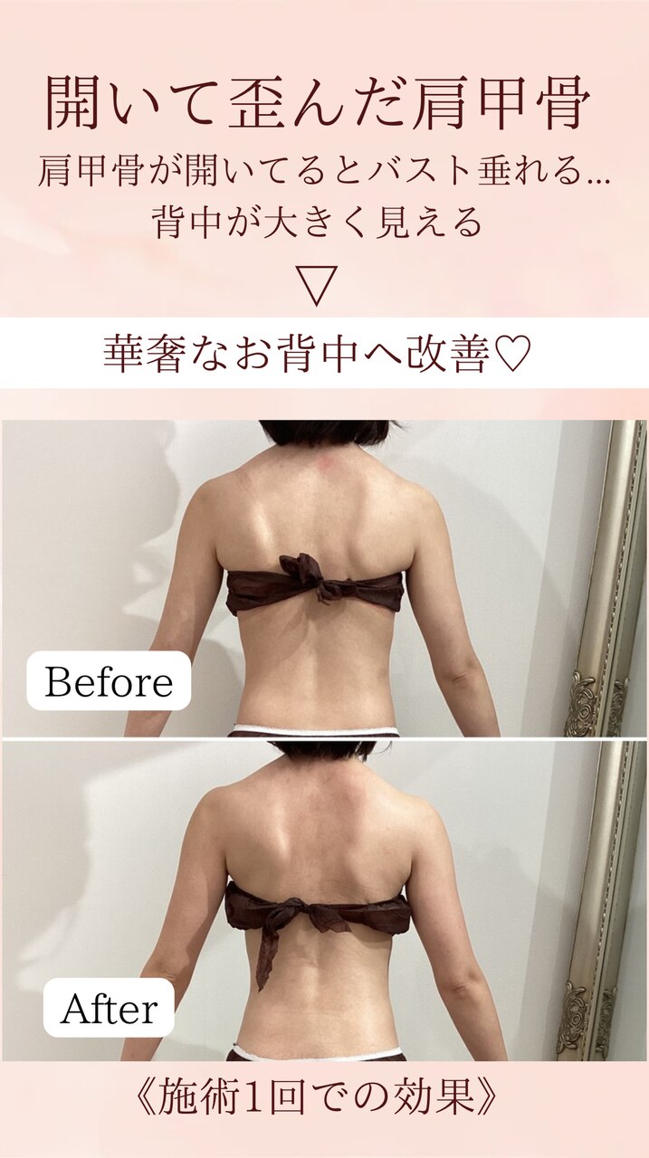 ドレスが映えるのは、デコルテと背中で決まる