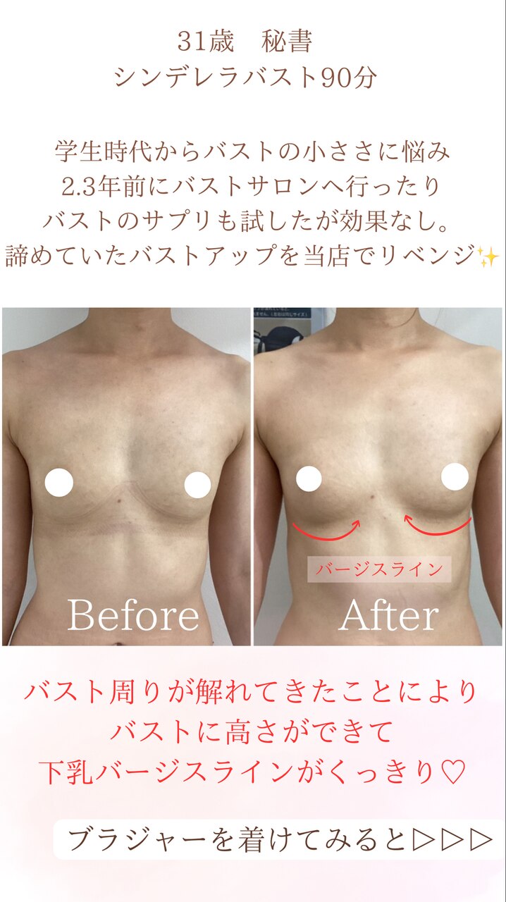 バージスラインで変わる。見た目も谷間もここが鍵