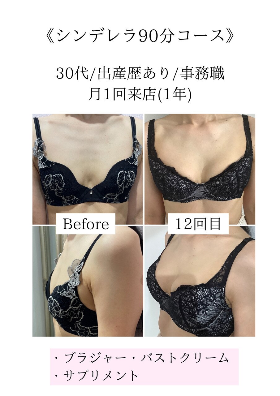 30代からの変化に。まだ間に合うバストケア
